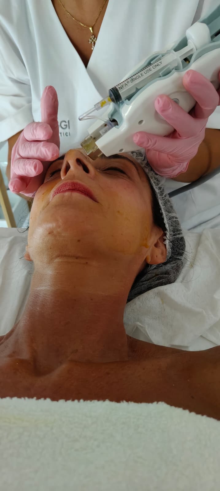 tratamiento facial realizado en Carmen Palacios Torremolinos